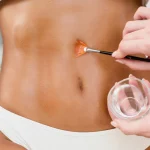 Skin Tightening
